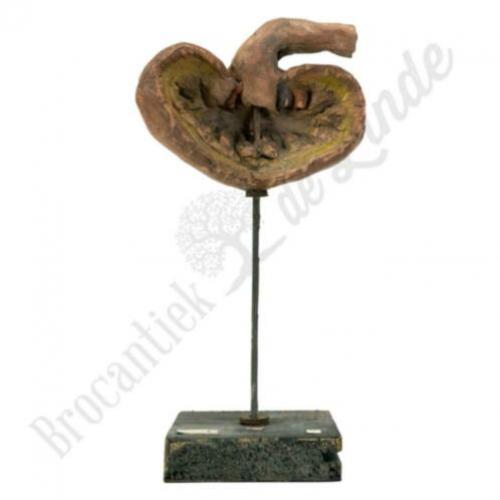 Unieke oude vintage Anatomisch model nier No.1